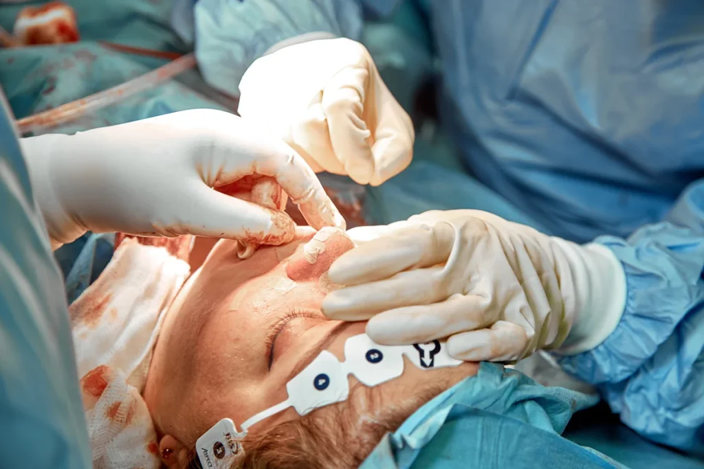 Une personne qui subit une opération du nez