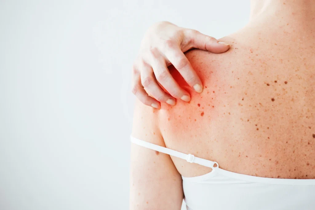 Une femme qui se gratte le haut du dos
