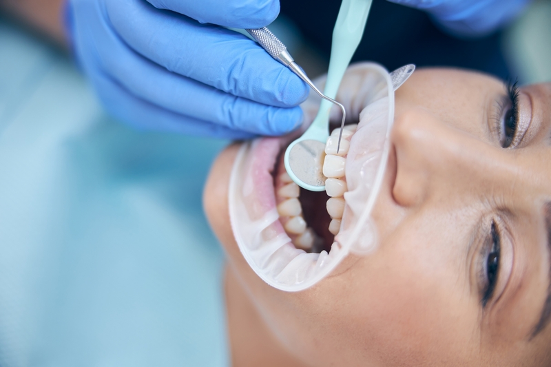 femme qui se fait poser des facettes dentaires