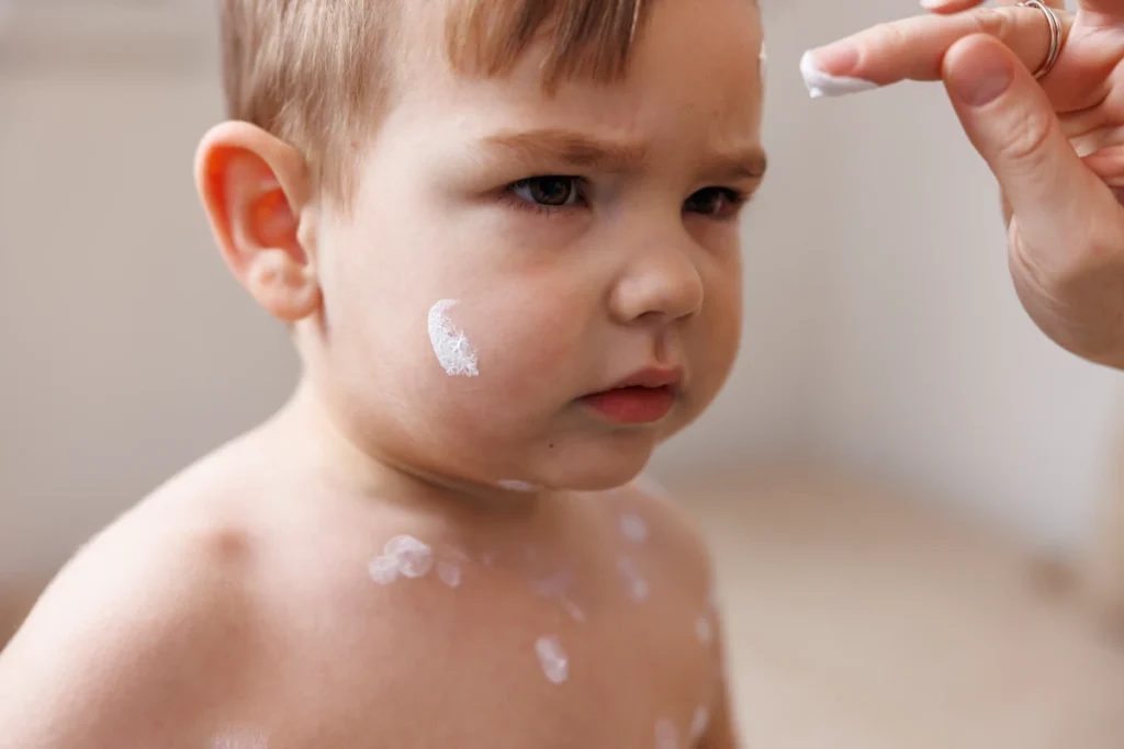 Une personne qui applique de la Biafine sur la peau d'un bébé